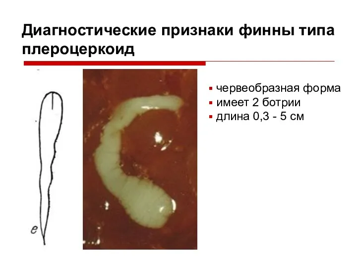 Диагностические признаки финны типа плероцеркоид червеобразная форма имеет 2 ботрии длина 0,3 - 5 см