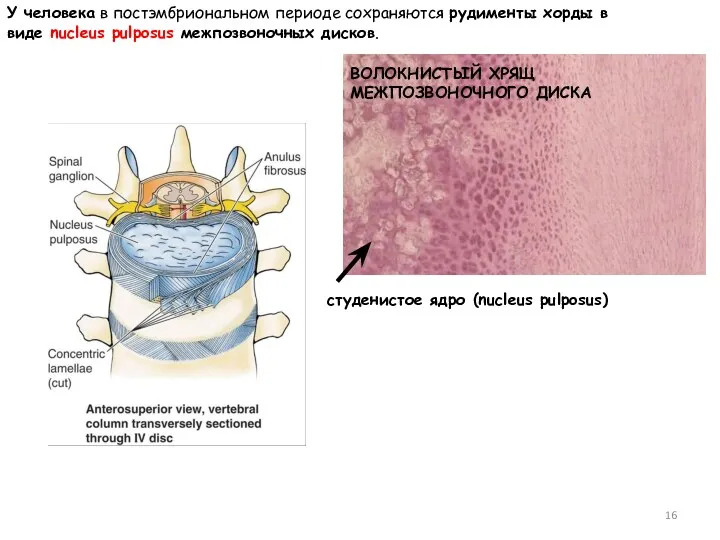 студенистое ядро (nucleus pulposus) ВОЛОКНИСТЫЙ ХРЯЩ МЕЖПОЗВОНОЧНОГО ДИСКА У человека