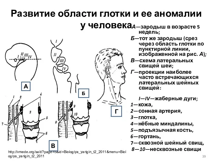 Развитие области глотки и ее аномалии у человека А—зародыш в