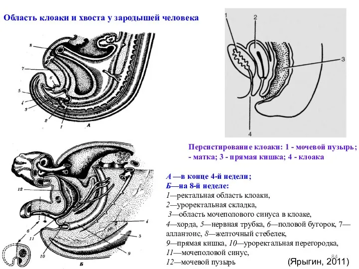 Область клоаки и хвоста у зародышей человека А —в конце