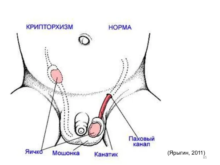 (Ярыгин, 2011)