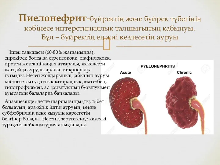 Пиелонефрит-бүйректің және бүйрек түбегінің көбінесе интерстициялық талшығының қабынуы. Бұл –