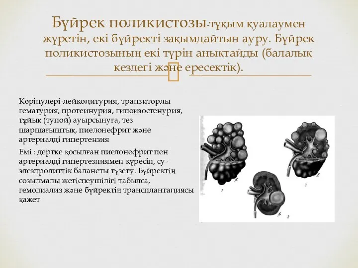 Бүйрек поликистозы-тұқым қуалаумен жүретін, екі бүйректі зақымдайтын ауру. Бүйрек поликистозының