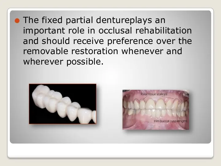 The fixed partial dentureplays an important role in occlusal rehabilitation