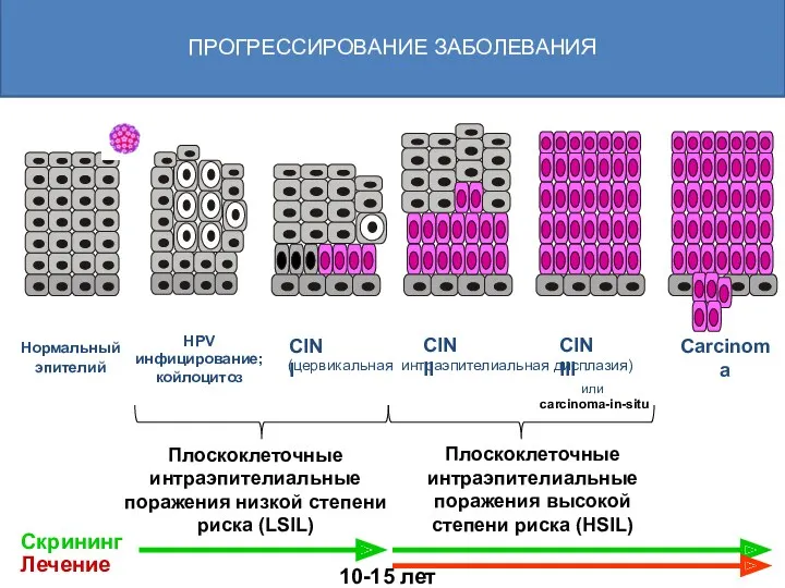 Плоскоклеточные интраэпителиальные поражения низкой степени риска (LSIL) Плоскоклеточные интраэпителиальные поражения