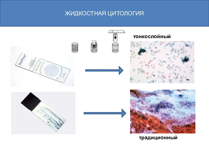 тонкослойный традиционный ЖИДКОСТНАЯ ЦИТОЛОГИЯ