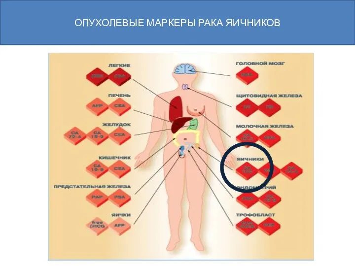 ОПУХОЛЕВЫЕ МАРКЕРЫ РАКА ЯИЧНИКОВ