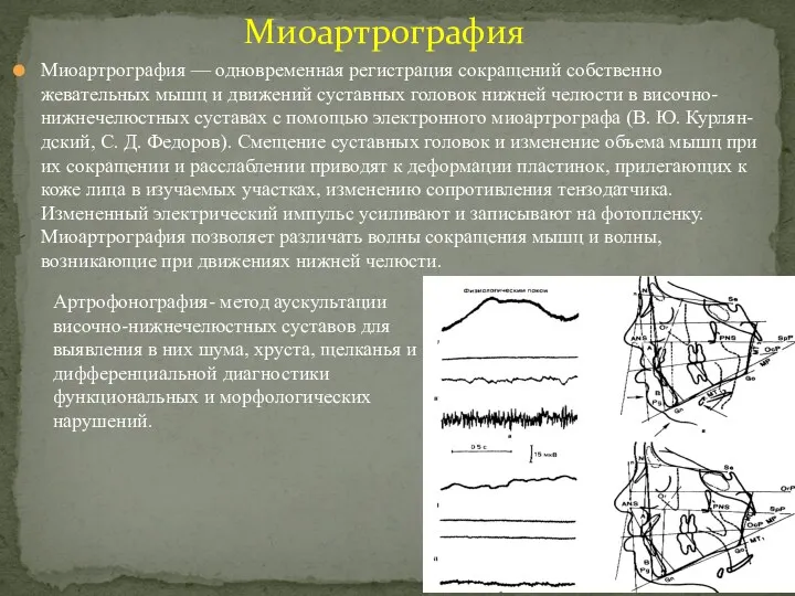 Миоартрография — одновременная регистрация сокращений собственно жевательных мышц и движений