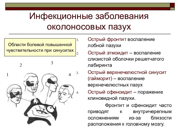 Инфекционные заболевания околоносовых пазух Острый фронтит воспаление лобной пазухи Острый