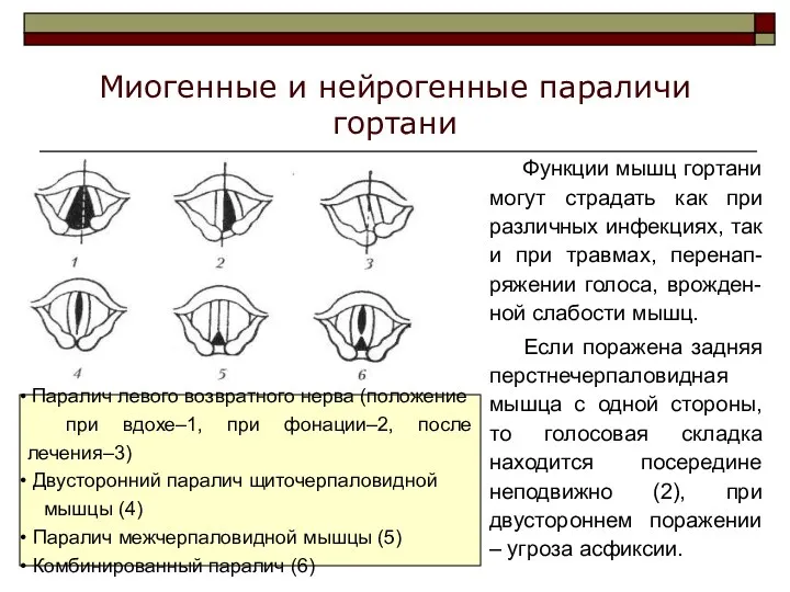 Миогенные и нейрогенные параличи гортани Функции мышц гортани могут страдать