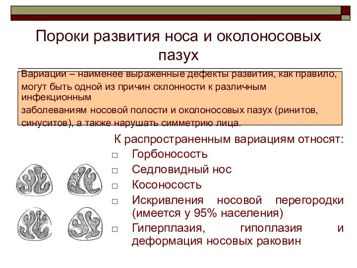 Пороки развития носа и околоносовых пазух К распространенным вариациям относят: