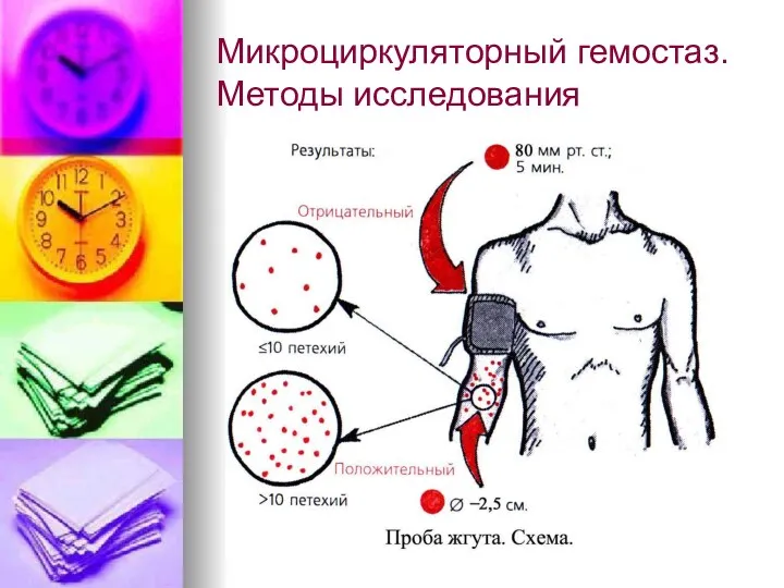 Микроциркуляторный гемостаз. Методы исследования