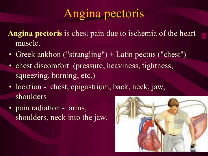 Angina pectoris Angina pectoris is chest pain due to ischemia