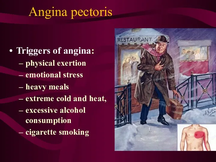 Angina pectoris Triggers of angina: physical exertion emotional stress heavy