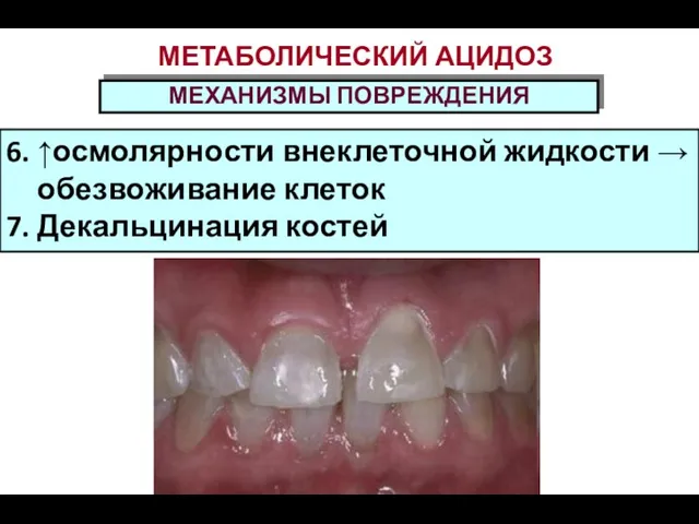 МЕТАБОЛИЧЕСКИЙ АЦИДОЗ МЕХАНИЗМЫ ПОВРЕЖДЕНИЯ 6. ↑осмолярности внеклеточной жидкости → обезвоживание клеток 7. Декальцинация костей