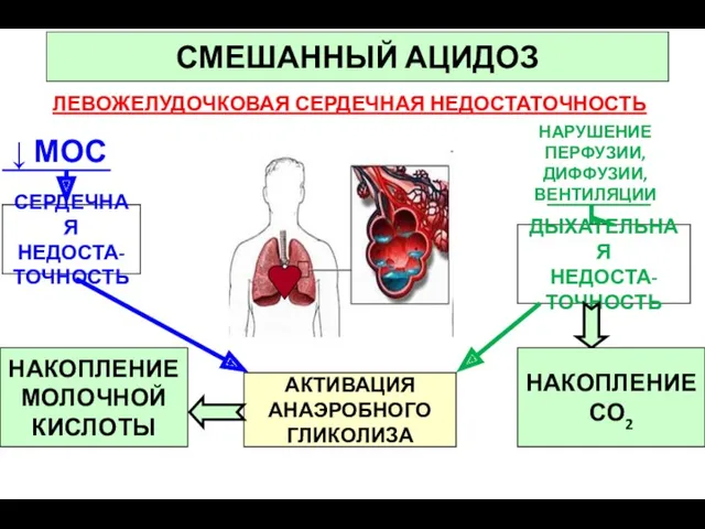 ЛЕВОЖЕЛУДОЧКОВАЯ СЕРДЕЧНАЯ НЕДОСТАТОЧНОСТЬ СМЕШАННЫЙ АЦИДОЗ НАРУШЕНИЕ ПЕРФУЗИИ, ДИФФУЗИИ, ВЕНТИЛЯЦИИ ↓ МОС