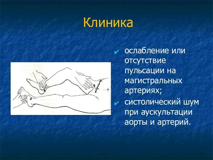 Клиника ослабление или отсутствие пульсации на магистральных артериях; систолический шум при аускультации аорты и артерий.