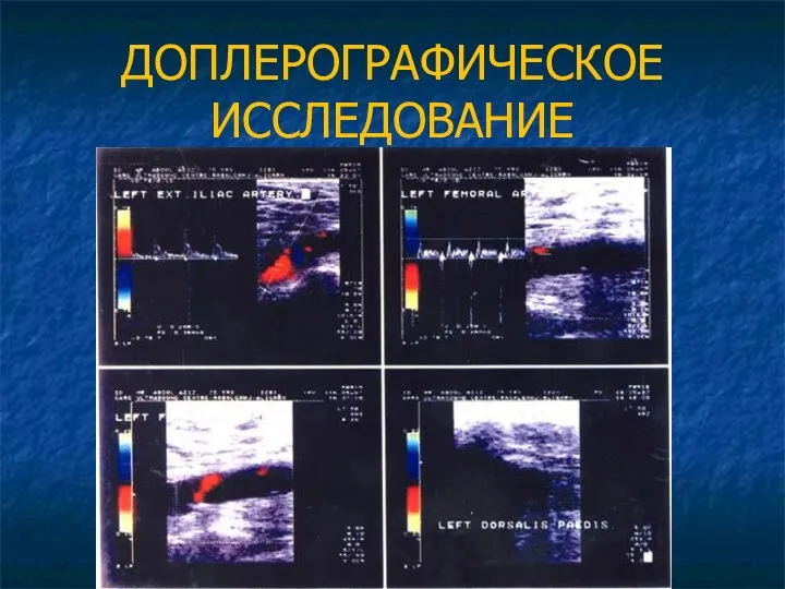 ДОПЛЕРОГРАФИЧЕСКОЕ ИССЛЕДОВАНИЕ