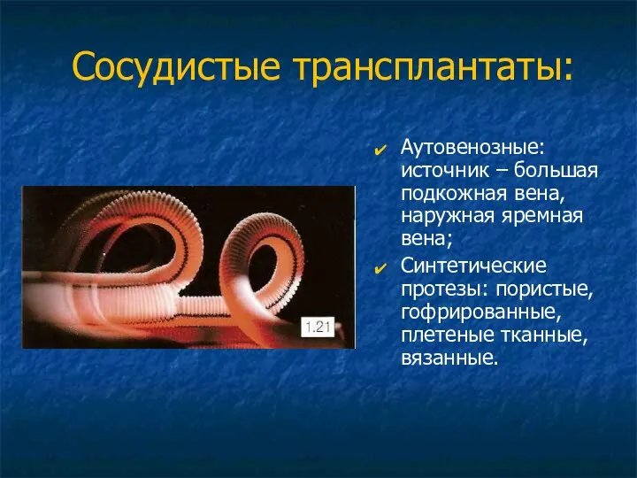 Сосудистые трансплантаты: Аутовенозные: источник – большая подкожная вена, наружная яремная