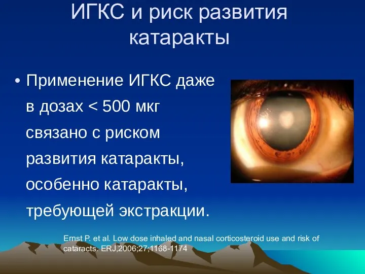 ИГКС и риск развития катаракты Применение ИГКС даже в дозах Ernst P. et