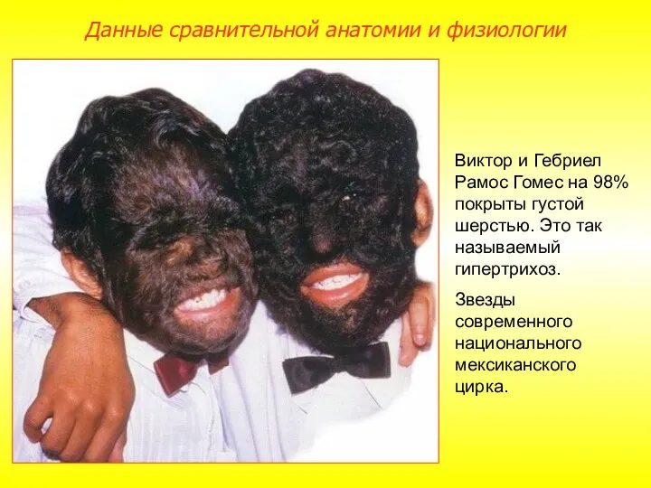 Виктор и Гебриел Рамос Гомес на 98% покрыты густой шерстью.