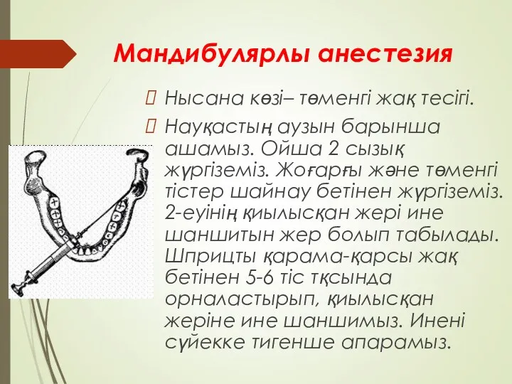 Мандибулярлы анестезия Нысана көзі– төменгі жақ тесігі. Науқастың аузын барынша