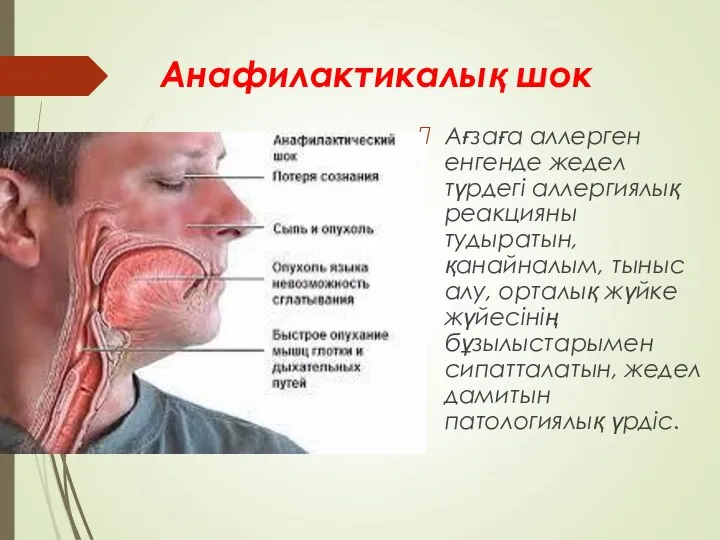 Анафилактикалық шок Ағзаға аллерген енгенде жедел түрдегі аллергиялық реакцияны тудыратын,