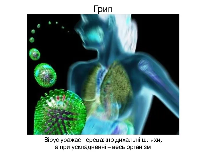 Грип Вірус уражає переважно дихальні шляхи, а при ускладненні – весь організм