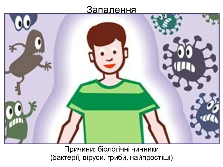 Запалення Причини: біологічні чинники (бактерії, віруси, гриби, найпростіші)