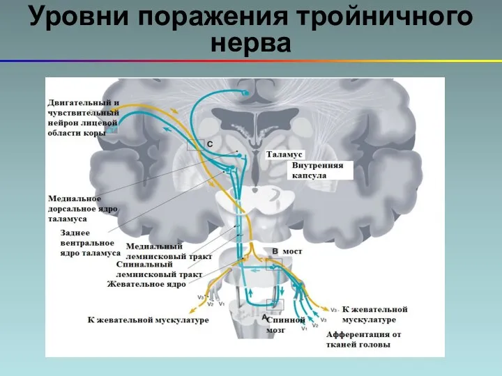 Уровни поражения тройничного нерва