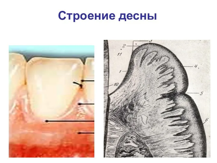 Строение десны