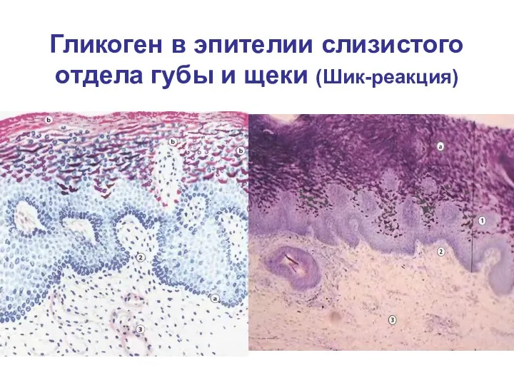 Гликоген в эпителии слизистого отдела губы и щеки (Шик-реакция)