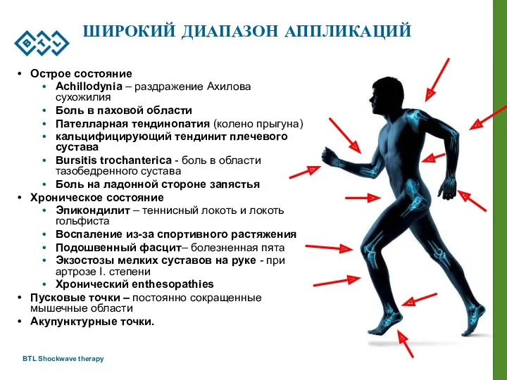 BTL Shockwave therapy ШИРОКИЙ ДИАПАЗОН АППЛИКАЦИЙ Острое состояние Achillodynia –