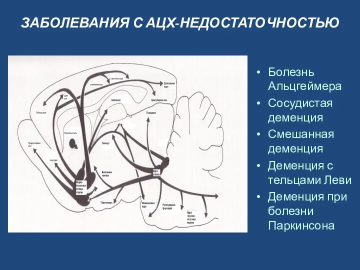 ЗАБОЛЕВАНИЯ С АЦХ-НЕДОСТАТОЧНОСТЬЮ Болезнь Альцгеймера Сосудистая деменция Смешанная деменция Деменция