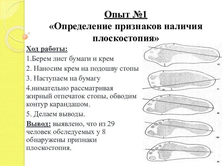 Опыт №1 «Определение признаков наличия плоскостопия» Ход работы: 1.Берем лист