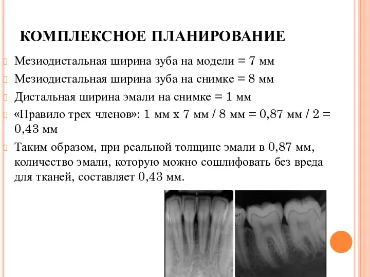 КОМПЛЕКСНОЕ ПЛАНИРОВАНИЕ Мезиодистальная ширина зуба на модели = 7 мм Мезиодистальная ширина зуба