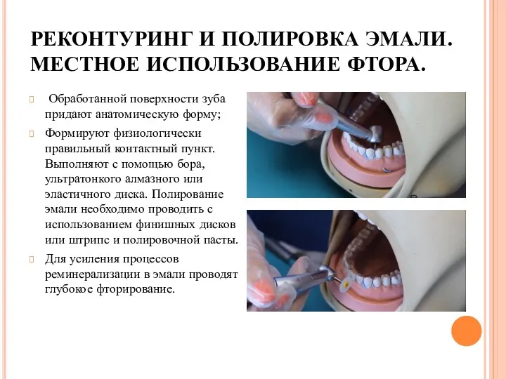 РЕКОНТУРИНГ И ПОЛИРОВКА ЭМАЛИ. МЕСТНОЕ ИСПОЛЬЗОВАНИЕ ФТОРА. Обработанной поверхности зуба придают анатомическую форму;