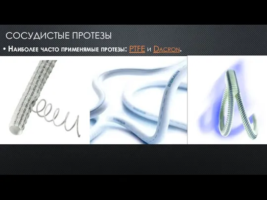СОСУДИСТЫЕ ПРОТЕЗЫ Наиболее часто применямые протезы: PTFE и Dacron.