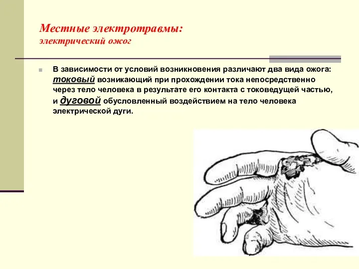 Местные электротравмы: электрический ожог В зависимости от условий возникновения различают