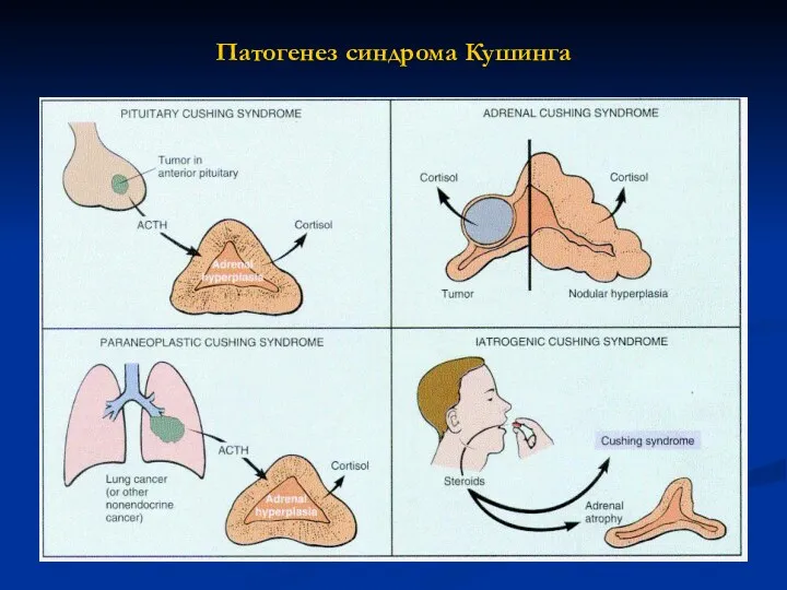 Патогенез синдрома Кушинга