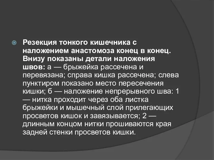 Резекция тон­кого кишечника с наложением анастомоза конец в ко­нец. Внизу показаны де­тали наложения