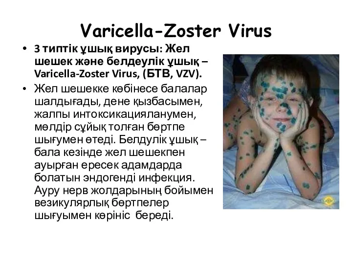 Varicella-Zoster Virus 3 типтік ұшық вирусы: Жел шешек және белдеулік