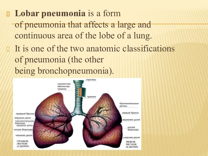 Lobar pneumonia is a form of pneumonia that affects a large and continuous