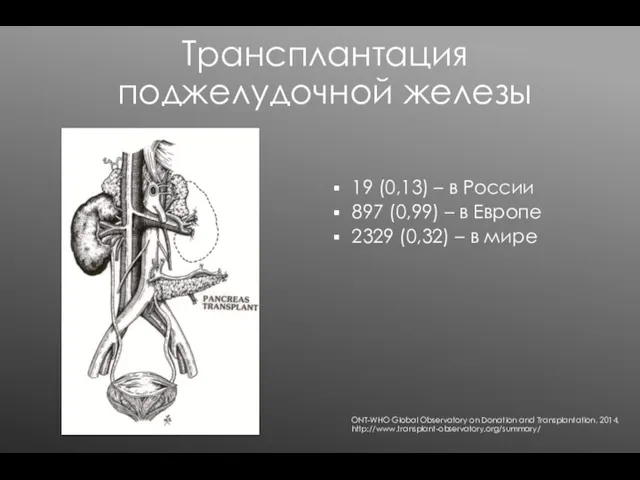 Трансплантация поджелудочной железы 19 (0,13) – в России 897 (0,99)