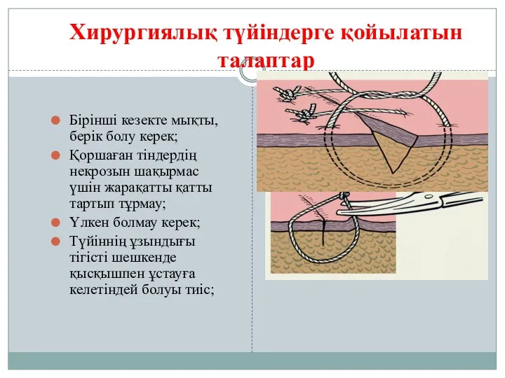 Хирургиялық түйіндерге қойылатын талаптар Бірінші кезекте мықты, берік болу керек; Қоршаған тіндердің некрозын