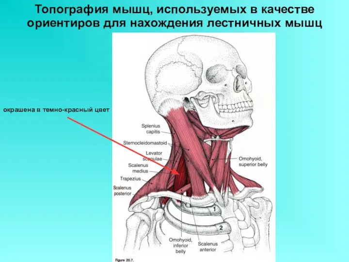 Топография мышц, используемых в качестве ориентиров для нахождения лестничных мышц окрашена в темно-красный цвет