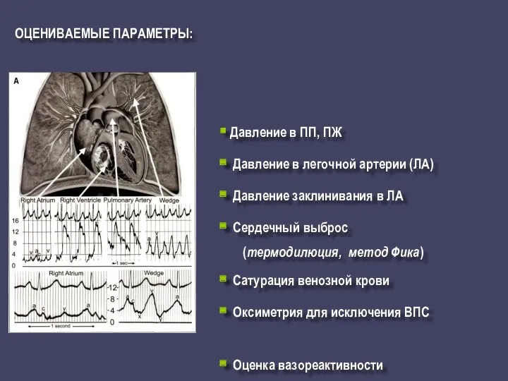 ОЦЕНИВАЕМЫЕ ПАРАМЕТРЫ: Давление в ПП, ПЖ Давление в легочной артерии