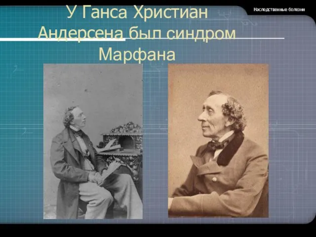 Наследственные болезни У Ганса Христиан Андерсена был синдром Марфана