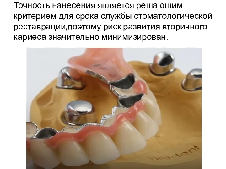 Точность нанесения является решающим критерием для срока службы стоматологической реставрации,поэтому риск развития вторичного кариеса значительно минимизирован.