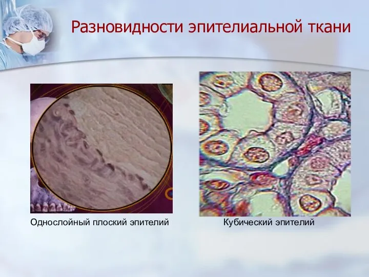 Разновидности эпителиальной ткани Кубический эпителий Однослойный плоский эпителий